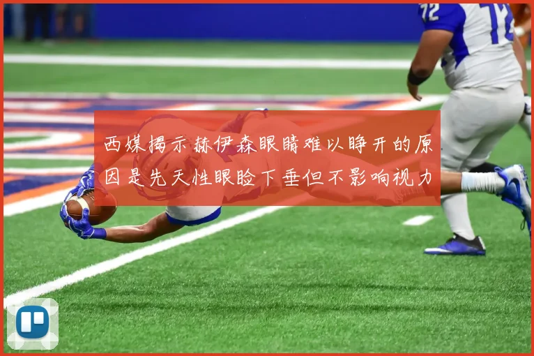 西媒揭示赫伊森眼睛难以睁开的原因是先天性眼睑下垂但不影响视力